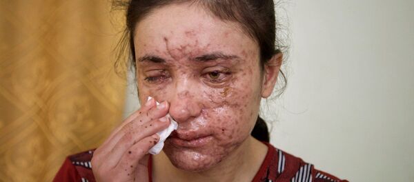 Menina yazidi de 18 anos de idade, Jesidin Lamiya Adschi Baschar, que foi espancada e estuprada muitas vezes no seu cativeiro do Daesh Menina yazidi de 18 anos de idade, Jesidin Lamiya Adschi Baschar, que foi espancada e estuprada muitas vezes no seu cativeiro do Daesh - Sputnik Brasil