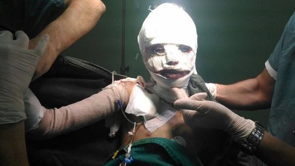 Ahd Al-Khaderi, menina síria que sofreu de incêndio e foi objeto de propaganda antes do incêndio Ahd Al-Khaderi, menina síria que sofreu de incêndio e foi objeto de propaganda antes do incêndio - Sputnik Brasil