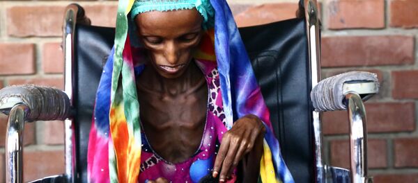 Saeeda Ahmed, de 18 anos de idade, a imagem dramática da fome no hospital da cidade portuária de Hodeidah, Iêmen. Segundo a UNICEF, no Iêmen três milhões de pessoas precisam de alimentos e meio milhão de crianças sofrem de desnutrição - Sputnik Brasil