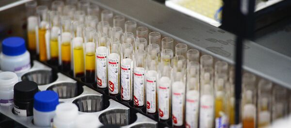 Análise de sangue. Diagnóstico das doenças - Sputnik Brasil