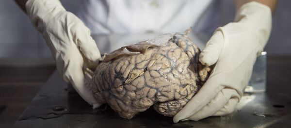 Doutora Diana Rivas exibe cérebro humano no Museu de Neuropatologia em Lima, Peru, 16 de dezembro de 2016 - Sputnik Brasil
