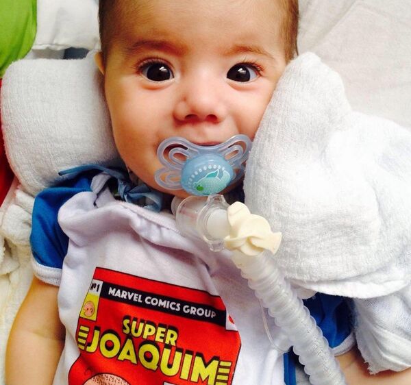 O menino Joaquim, de 8 meses, sofre de Amiatrofia Muscular Espinhal - Sputnik Brasil