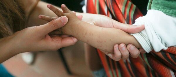 Los voluntarios de Health&Help en Nicaragua - Sputnik Brasil