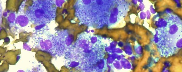 Fungo Histoplasma capsulatum - Sputnik Brasil